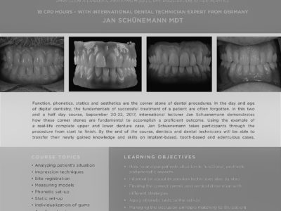 AICE Denture Patient Course Jan Schuenemann