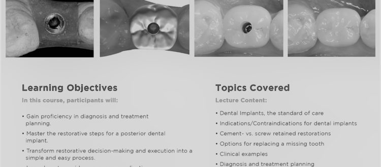 restoring single dental implant cpd course flyer