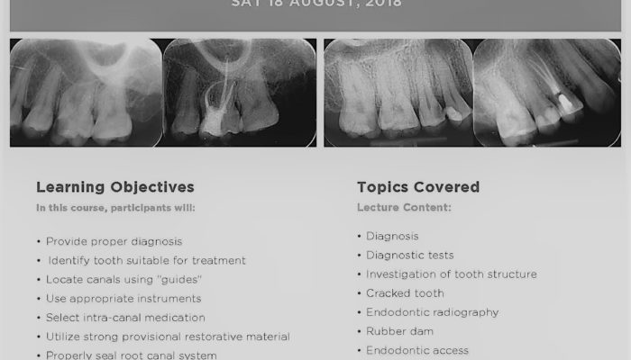 Endodontics CPD course flyer black and white