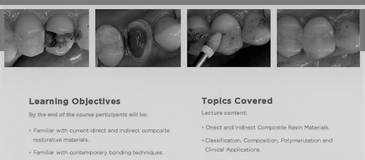 direct and indirect composite restorations course