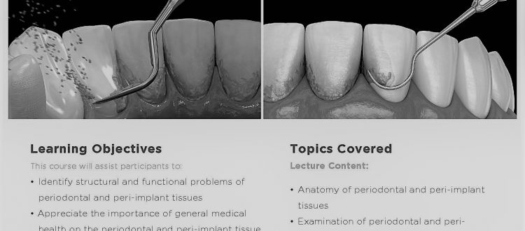 periodontics course